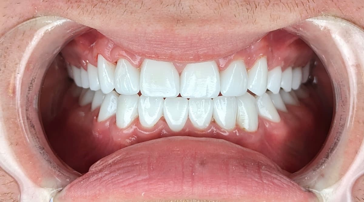 Grand Dental klinika - pre i posle