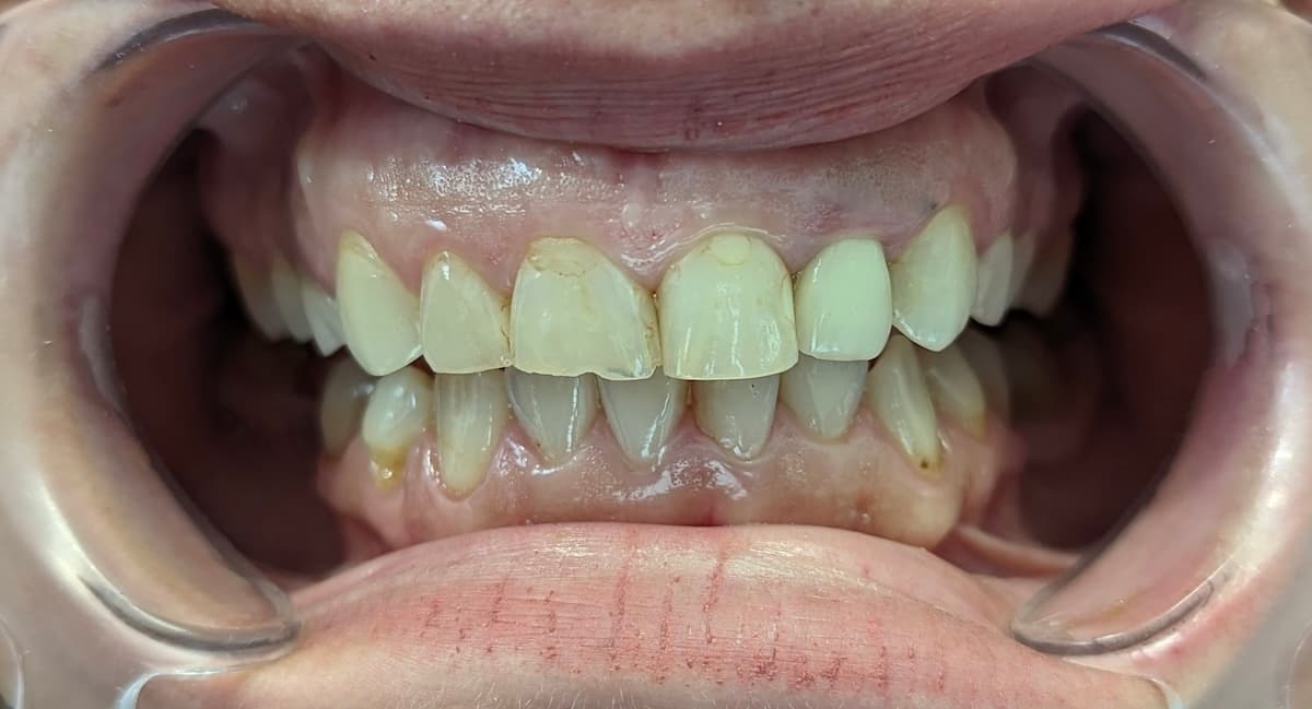 Grand Dental klinika - pre i posle