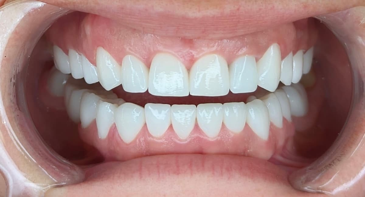 Grand Dental klinika - pre i posle