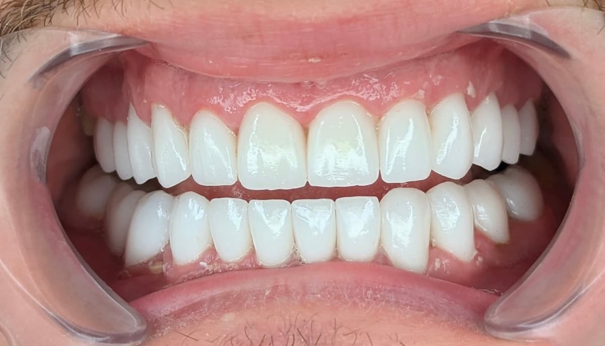 Grand Dental klinika - pre i posle
