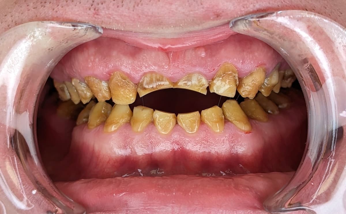 Grand Dental klinika - pre i posle