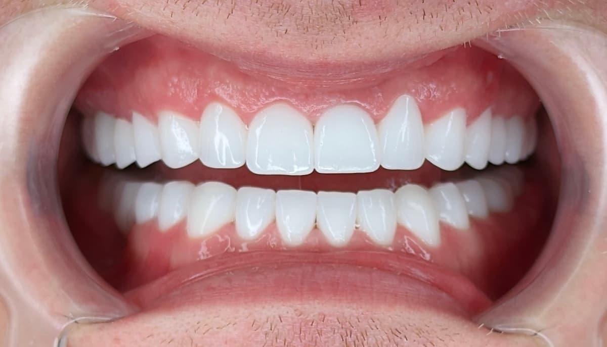 Grand Dental klinika - pre i posle